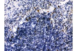 IHC testing of FFPE mouse spleen with IKAROS antibody. (IKZF1 antibody)