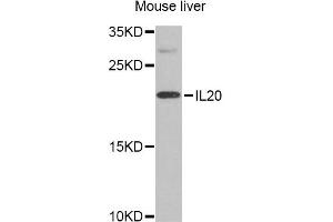 Western blot analysis of extracts of mouse liver, using IL20 Antibody. (IL-20 antibody)