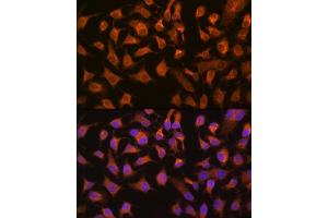 Immunofluorescence analysis of HeLa cells using PEPCK/PEPCK/PCK2 Rabbit mAb (ABIN7269306) at dilution of 1:100 (40x lens). (PEPCK antibody)