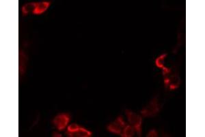 ABIN6274833 staining Hela by IF/ICC. (A4GNT antibody  (C-Term))