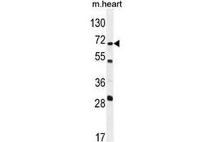 Western blot analysis in mouse heart tissue lysates (35ug/lane)using NT5C1B Antibody (N-term).