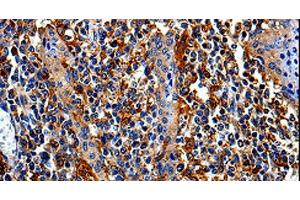 Immunohistochemistry of paraffin-embedded Human tonsil tissue using COX16 Polyclonal Antibody at dilution 1:50 (COX16 antibody)