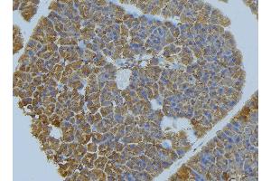 ABIN6277034 at 1/100 staining Human pancreas tissue by IHC-P. (PVRL1 antibody  (Internal Region))