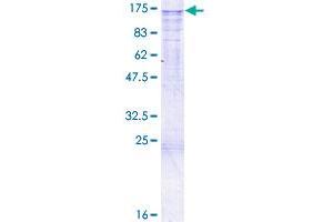 CHERP Protein (AA 1-884) (GST tag)