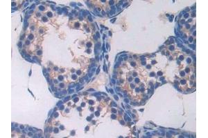 Immunohistochemistry (IHC) image for anti-HLA-DR-gamma (CD74) (AA 64-205) antibody (ABIN7443722)