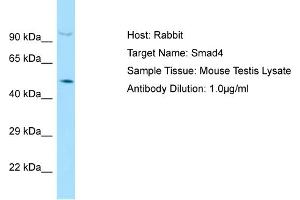 Host: Rabbit Target Name: SMAD4 Sample Tissue: Mouse Testis Antibody Dilution: 1ug/ml (SMAD4 antibody  (C-Term))