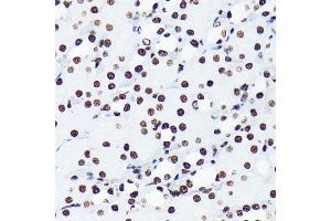 Immunohistochemistry of paraffin-embedded mouse kidney using Acetyl-Histone H4-K5 antibody (ABIN7267743) at dilution of 1:100 (40x lens). (Histone H4 antibody  (acLys5))