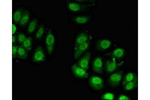 Immunofluorescent analysis of A549 cells using ABIN7142772 at dilution of 1:100 and Alexa Fluor 488-congugated AffiniPure Goat Anti-Rabbit IgG(H+L) (RPL23A antibody  (AA 1-92))