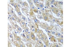 Immunohistochemistry of paraffin-embedded Human liver using SGSH Polyclonal Antibody at dilution of 1:100 (40x lens). (SGSH antibody)