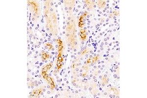 Immunohistochemistry of paraffin embedded mouse kidney using ASBT (ABIN7075648) at dilution of 1:1500 (400x lens) (SLC10A2 antibody)