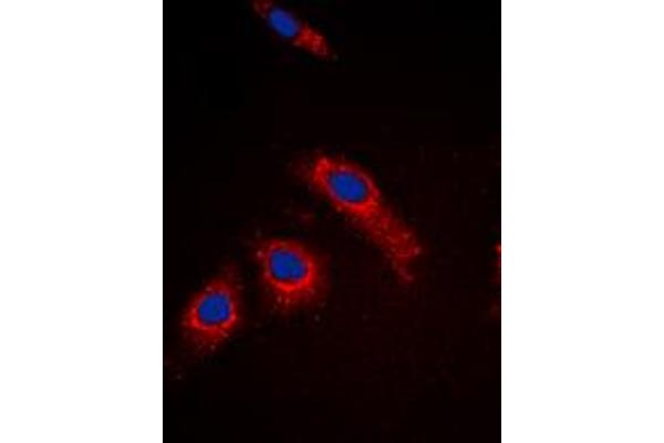 RPL3L antibody  (Center)