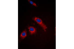Immunofluorescent analysis of RPL3L staining in MCF7 cells. (RPL3L antibody  (Center))