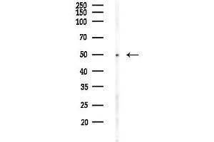 Western blot analysis of lysates from PC12 cells(LPS 4h treatment), using Phospho-Chk1 (Ser301) Antibody at 1/1000 dilution.