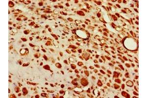 Immunohistochemistry of paraffin-embedded human placenta tissue using ABIN7171322 at dilution of 1:100 (T-Box 6 antibody  (AA 295-436))