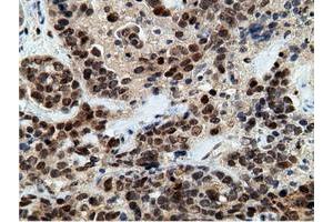 Immunohistochemical staining of paraffin-embedded Human colon tissue using anti-EPM2AIP1 mouse monoclonal antibody. (EPM2AIP1 antibody)