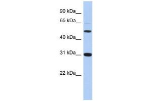 PI16 antibody used at 1 ug/ml to detect target protein. (PI16 antibody  (Middle Region))