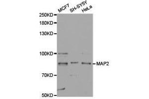 Western Blotting (WB) image for anti-Microtubule-Associated Protein 2 (MAP2) antibody (ABIN1873602) (MAP2 antibody)