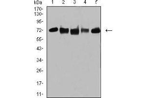 Western blot analysis using TRIM25 mouse mAb against MCF-7 (1), MCF-7 (2), K562 (3), A549 (4), and MOLT4 (5) cell lysate. (TRIM25 antibody  (AA 211-360))