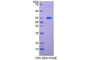 SDS-PAGE analysis of Rat Insulin Like Growth Factor Binding Protein 4 (IGFBP4) Protein. (IGFBP4 Protein)
