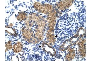 GTF3C5 antibody was used for immunohistochemistry at a concentration of 4-8 ug/ml to stain EpitheliaI cells of renal tubule (arrows) in Human Kidney. (GTF3C5 antibody  (N-Term))