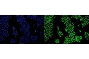 IF analysis of PPAR gamma/PPARG using anti-PPAR gamma/PPARG antibody (ABIN7602078). (PPARG antibody  (AA 58-329))