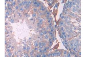Detection of JAK2 in Rat Testis Tissue using Polyclonal Antibody to Janus Kinase 2 (JAK2) (JAK2 antibody  (AA 916-1103))
