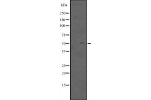 Western blot analysis of TFAP2D expression in TFAP2D transfected 293T cell lysate,The lane on the left is treated with the antigen-specific peptide.