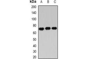 Western blot analysis of IGF2BP3 expression in Hela (A), PC3 (B), NIH3T3 (C) whole cell lysates. (IGF2BP3 antibody)