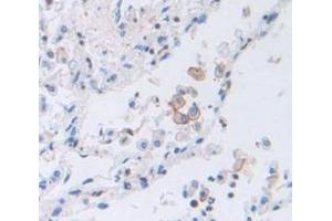 Figure. (PTGER2 antibody  (AA 155-355))
