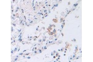 Figure. (PTGER2 antibody  (AA 155-355))