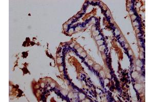 Immunohistochemistry of paraffin-embedded human testis tissue using ABIN7156606 at dilution of 1:100 (IL28RA antibody  (AA 21-228))