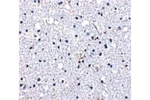 Immunohistochemistry (IHC) image for anti-Duffy Blood Group, Chemokine Receptor (DARC) (N-Term) antibody (ABIN1031343)
