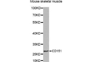 Western blot analysis of extracts of mouse skeletal muscle, using CD151 Antibody. (CD151 antibody)
