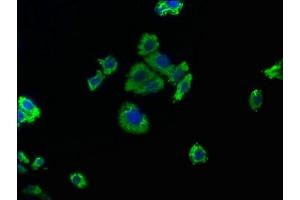 Immunofluorescence staining of HepG2 cells with ABIN7139763 at 1:50, counter-stained with DAPI.