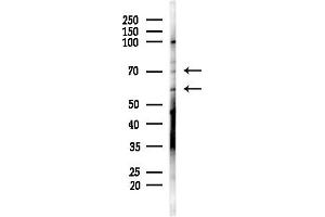 anti-Solute Carrier Family 2 (Facilitated Glucose/fructose Transporter), Member 5 (SLC2A5) (N-Term) antibody