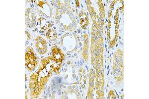 Immunohistochemistry (IHC) image for anti-Tumor Necrosis Factor Receptor Superfamily, Member 11b (TNFRSF11B) (AA 22-280) antibody (ABIN3022915)