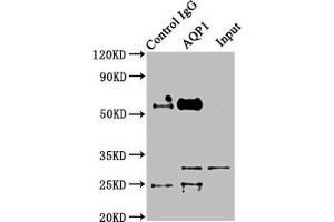 Immunoprecipitating AQP1 in Mouse skeletal muscle tissue Lane 1: Rabbit control IgG instead of ABIN7144499 in Mouse skeletal muscle tissue. (Aquaporin 1 antibody  (AA 220-269))