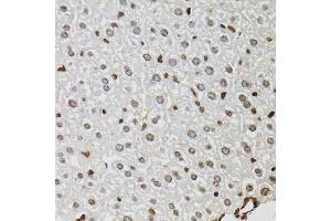 Immunohistochemistry of paraffin-embedded mouse liver using KDM4A antibody. (KDM4A antibody)