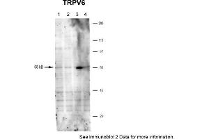Sample Type: hRetinal pigment epithelial cells, 4 individual donors (20ug)Primary Dilution: 1:1000Secondary Antibody: goat anti-rabbit-APSecondary Dilution: 1:2000Image Submitted by: Brian KennedyIndiana University Northwest . (TRPV6 antibody  (Middle Region))