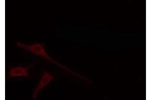 ABIN6274664 staining LOVO cells by IF/ICC. (CYTL1 antibody)