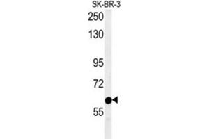 Western Blotting (WB) image for anti-Ras Association and DIL Domains (Radil) antibody (ABIN2995578) (Radil antibody)