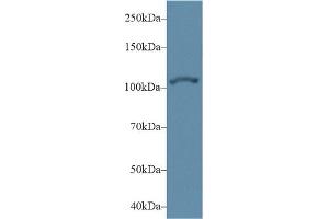 Detection of ACTN2 in Human Hela cell lysate using Polyclonal Antibody to Actinin Alpha 2 (ACTN2) (ACTN2 antibody  (AA 1-254))