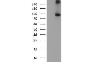 Western Blotting (WB) image for anti-Fibroblast Growth Factor Receptor 2 (FGFR2) antibody (ABIN1498248) (FGFR2 antibody)