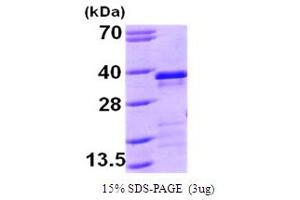 SDS-PAGE (SDS) image for Estrogen Receptor Binding Site Associated, Antigen, 9 (EBAG9) (AA 28-213) protein (His tag) (ABIN666873) (RCAS1 Protein (AA 28-213) (His tag))