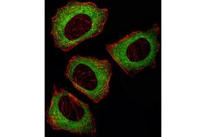 Fluorescent ige of  cell stained with MEK2 (P2K2) Antibody (Center) (ABIN392485 and ABIN2842062)/SA110819AW. (MEK2 antibody  (AA 262-292))