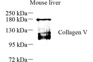 Western blot analysis of collagen alpha-1 (V) (ABIN7073547) at dilution of 1: 500 (Collagen Type V antibody)