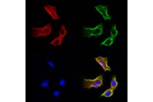 ABIN6265370 and ABIN6272981 staining Hela cells by IF/ICC.