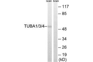 Western Blotting (WB) image for anti-TUBA1/3/4 (Tyr272) antibody (ABIN1848392) (TUBA1/3/4 (Tyr272) antibody)
