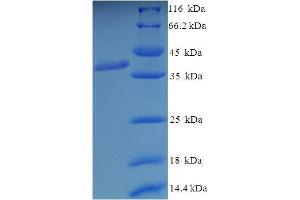 GRIK5 Protein (AA 143-238, Extracellular) (GST tag)