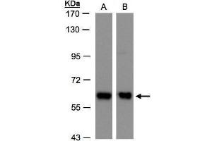 WB Image Sample(30 ug whole cell lysate) A:H1299 B:Hep G2, 7. (ARCN1 antibody)